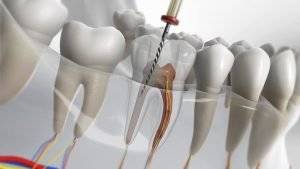 Endodontie