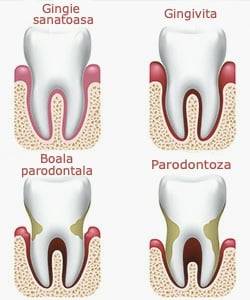 parodontologie