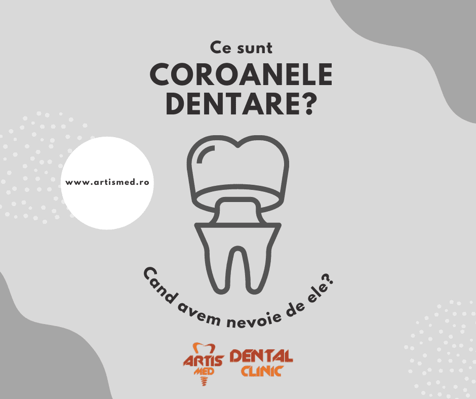 Ce sunt coroanele dentare